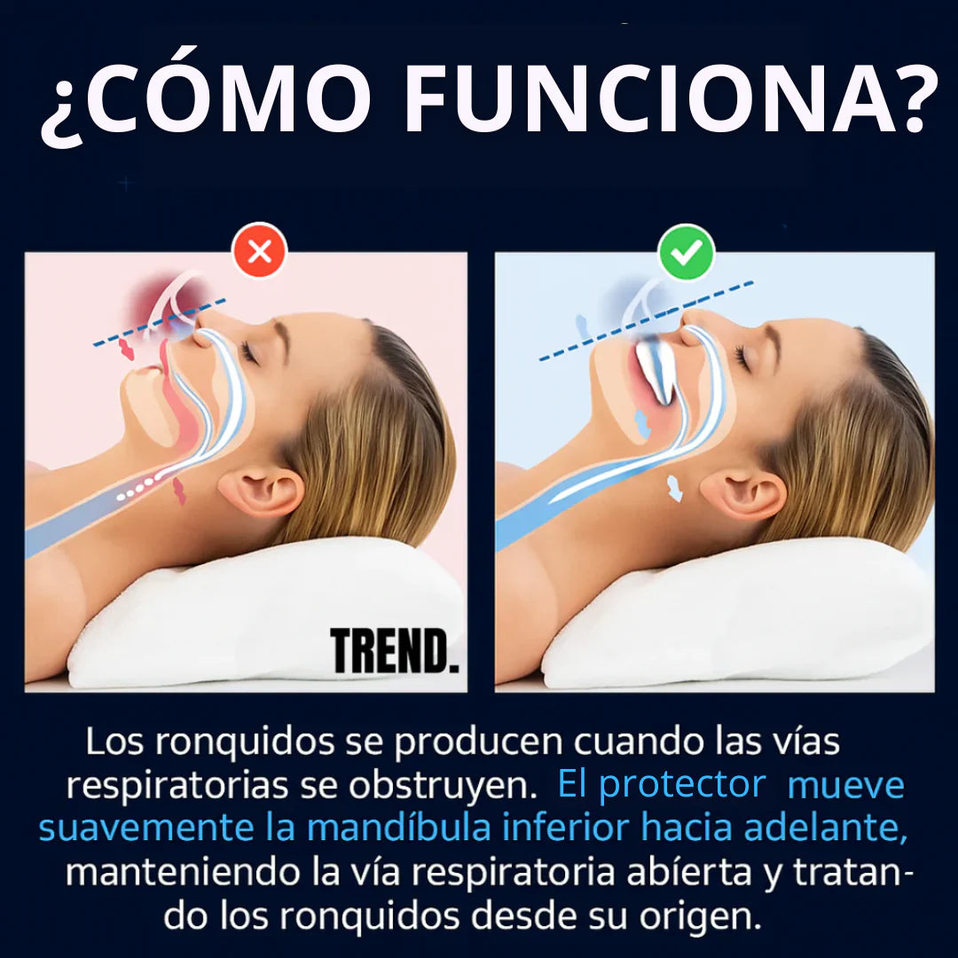 SilentSleep™ - Placa Anti bruxismo Apnea y Ronquido