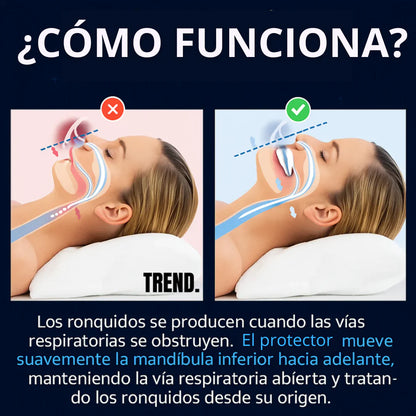 SilentSleep™ - Placa Anti bruxismo Apnea y Ronquido