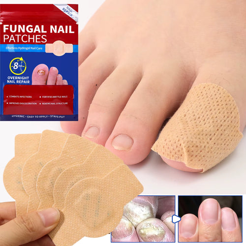 ¿Uñas amarillas o con hongos? Recupéralas mientras duermes con FungiPatch™